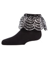 Metallic Scalloped Cotton Blend Anklet Socks : Color: Black Silver